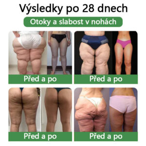 COROU™ SMGT-GLP-1 Nano Microneedle Patch 16 COROU™ SMGT-GLP-1 Nano Microneedle Patch