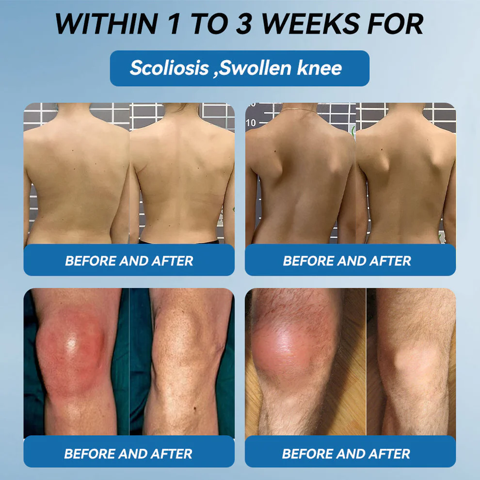 Zvoevo® BPC-157 Joint Healing Cream image Zvoevo® BPC-157 Joint Healing Cream