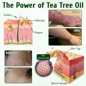 Timilk® DermaPure Tea Tree Healing Cream