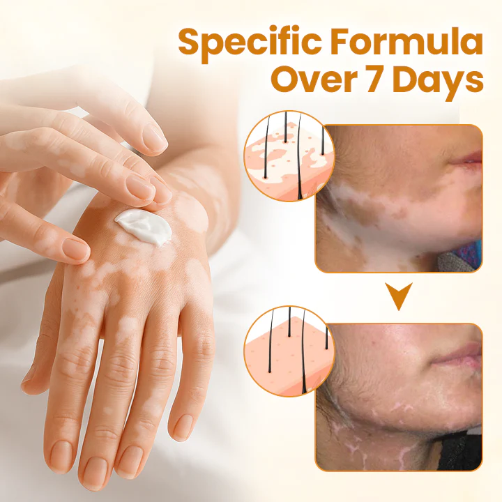 Timilk® VitiCalm Bee Venom Cream 5 Timilk® VitiCalm Bee Venom Cream