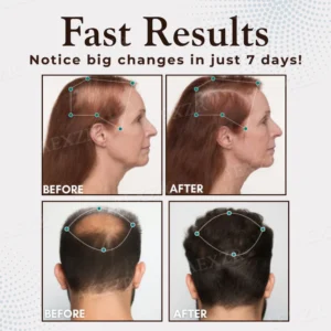 Hairgenz™ Hair Regrowth Capsules 8 Hairgenz™ Hair Regrowth Capsules