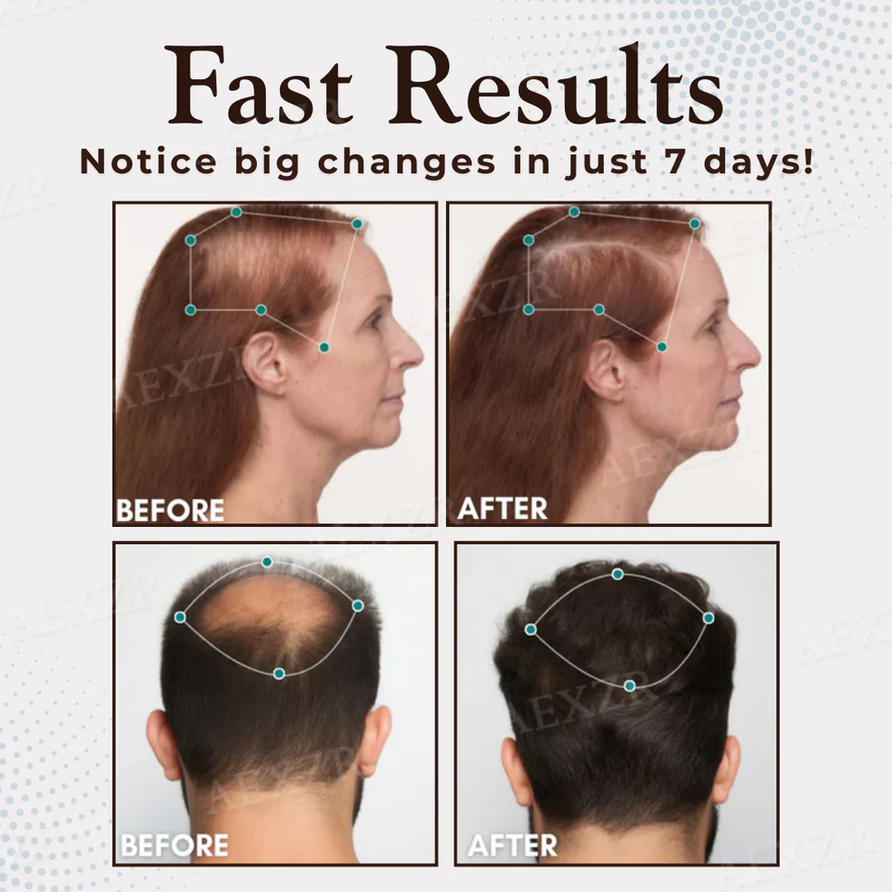 Hairgenz™ Hair Regrowth Capsules 2 Hairgenz™ Hair Regrowth Capsules