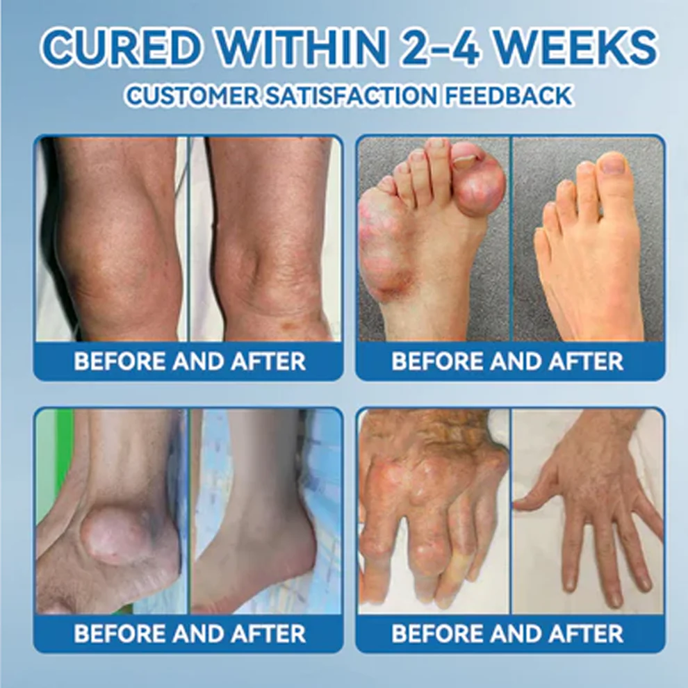 Zvoevo BPC-157 Joint Healing Cream 11 Zvoevo BPC-157 Joint Healing Cream