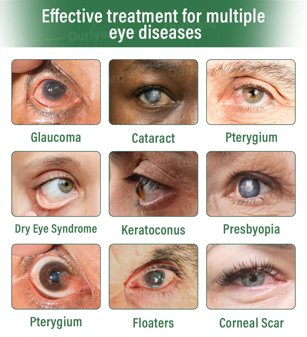 Ourlyard® OptiClear DualTech Eye Drops 4 Ourlyard® OptiClear DualTech Eye Drops