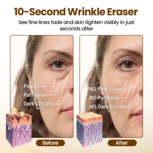 Oveallgo® Liftora 10s Wrinkle Serum 9 Oveallgo® Liftora 10s Wrinkle Serum