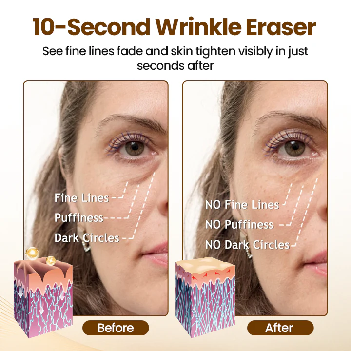 Oveallgo® Liftora 10s Wrinkle Serum 2 Oveallgo® Liftora 10s Wrinkle Serum