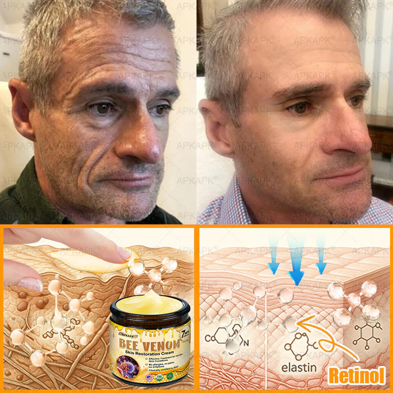 𝖠𝖯𝖪𝖠𝖯𝖪® 𝖡𝖾𝖾 𝗏𝖾𝗇𝗈𝗆 𝖲𝗄𝗂𝗇𝖱𝖾𝗌𝗍𝗈𝗋𝖺𝗍𝗂𝗈𝗇 𝖢𝗋𝖾𝖺𝗆 image 𝖠𝖯𝖪𝖠𝖯𝖪® 𝖡𝖾𝖾 𝗏𝖾𝗇𝗈𝗆 𝖲𝗄𝗂𝗇𝖱𝖾𝗌𝗍𝗈𝗋𝖺𝗍𝗂𝗈𝗇 𝖢𝗋𝖾𝖺𝗆 - Image 15