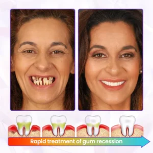 Oveallgo® BeeRenew Advanced Gum Healing Toothpaste 14 Oveallgo® BeeRenew Advanced Gum Healing Toothpaste