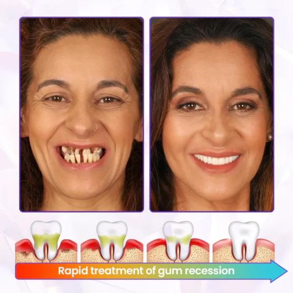 GUM CARE BeeRenew Advanced Gum Healing Toothpaste