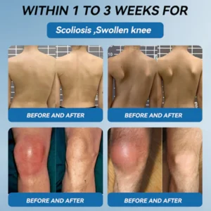 Zvoevo BPC-157 Joint Healing Cream 18 Zvoevo BPC-157 Joint Healing Cream