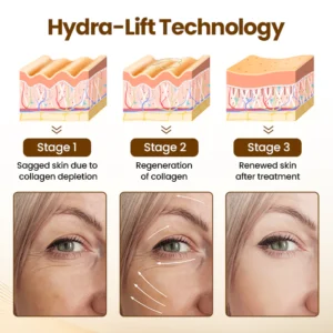 Oveallgo® Liftora 10s Wrinkle Serum 10 Oveallgo® Liftora 10s Wrinkle Serum