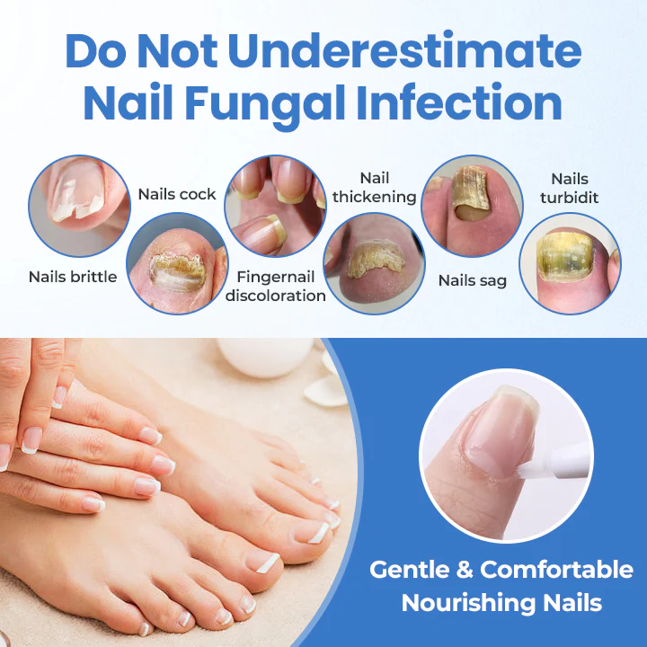 Timilk® MycoErase Nail Revive Pen 12 Timilk® MycoErase Nail Revive Pen