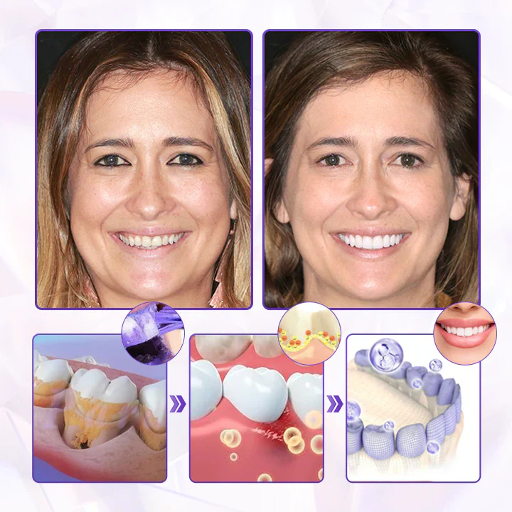 Oveallgo® BeeRenew Advanced Gum Healing Toothpaste 3 Oveallgo® BeeRenew Advanced Gum Healing Toothpaste