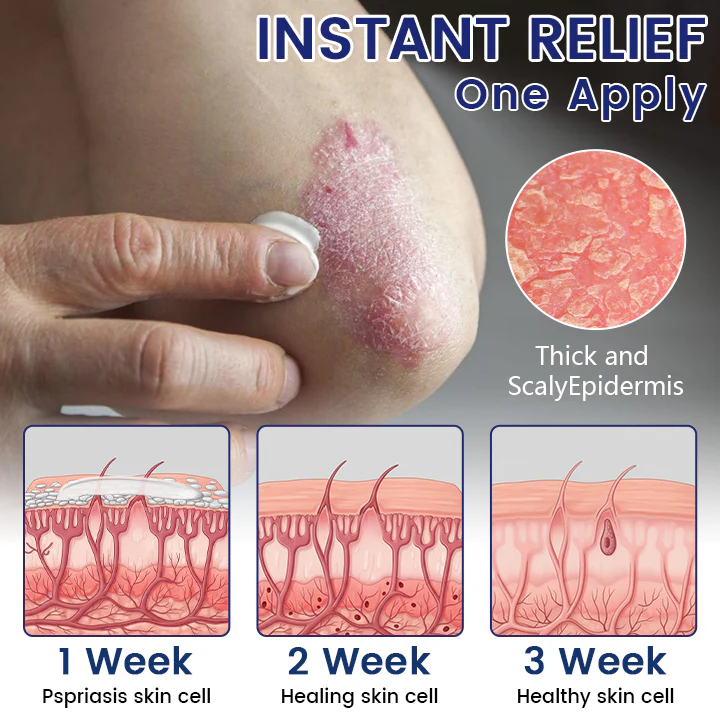 Timilk® DermaSooth Repair Cream 5 Timilk® DermaSooth Repair Cream