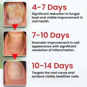 Dobshow® Fungi-Cure Max 10 Dobshow® Fungi-Cure Max