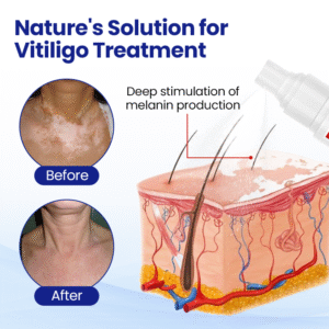 Cvreoz® Soothing Lipoma Ointment