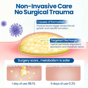 Cvreoz® Lipoma Removal Cream image Cvreoz® Lipoma Removal Cream