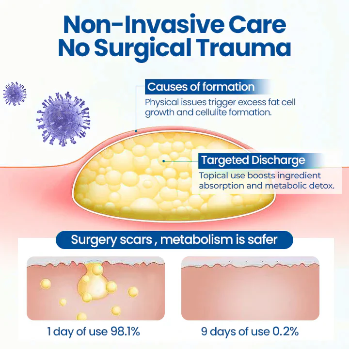 Cvreoz® Lipoma Removal Cream image Cvreoz® Lipoma Removal Cream