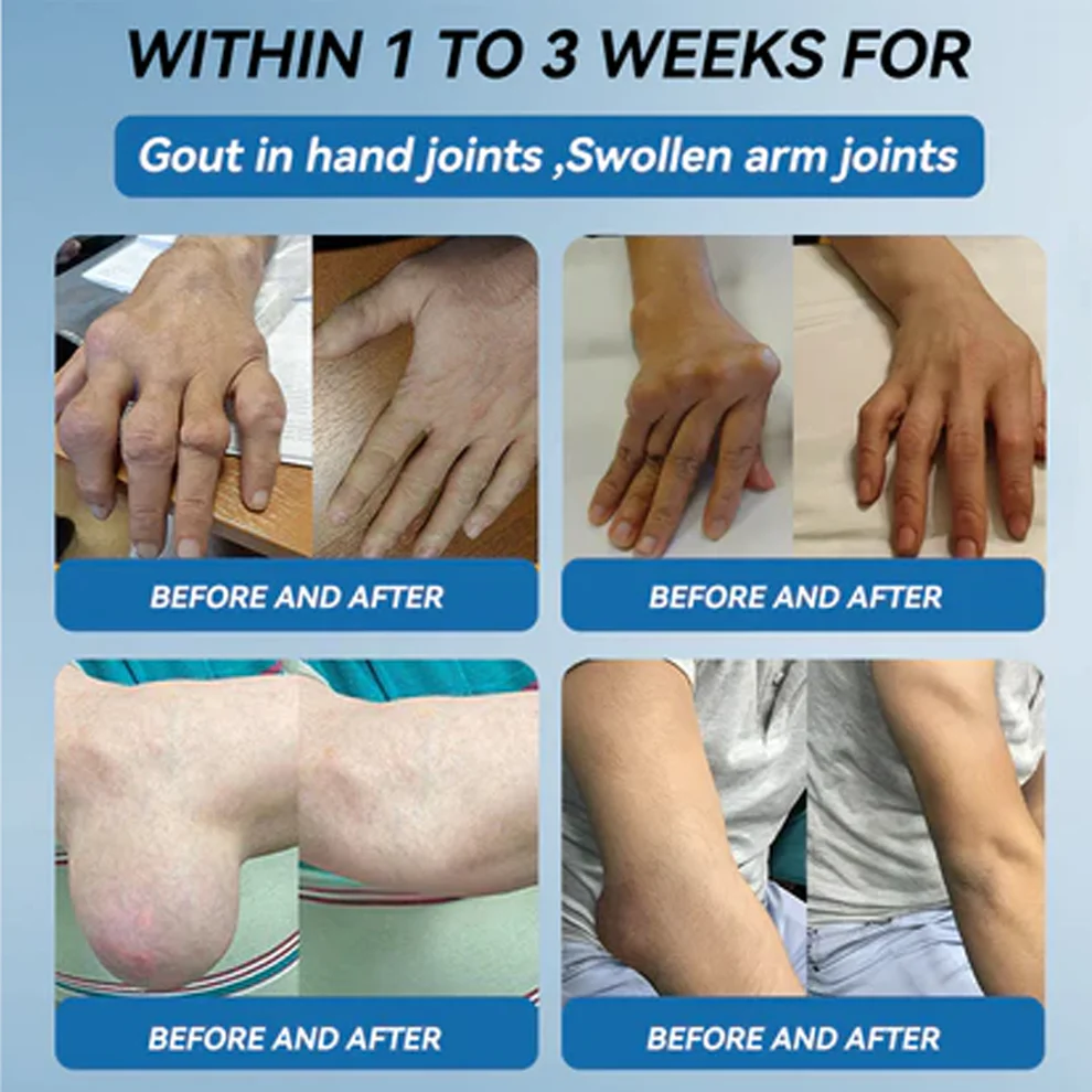 Zvoevo BPC-157 Joint Healing Cream 5 Zvoevo BPC-157 Joint Healing Cream