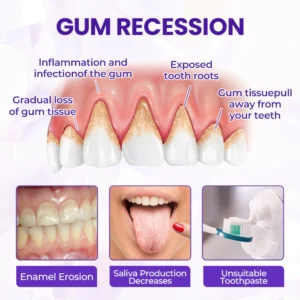 GUM CARE BeeRenew Advanced Gum Healing Toothpaste 15 GUM CARE BeeRenew Advanced Gum Healing Toothpaste