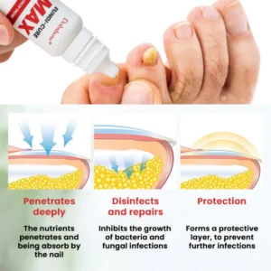 Dobshow® Fungi-Cure Max 11 Dobshow® Fungi-Cure Max