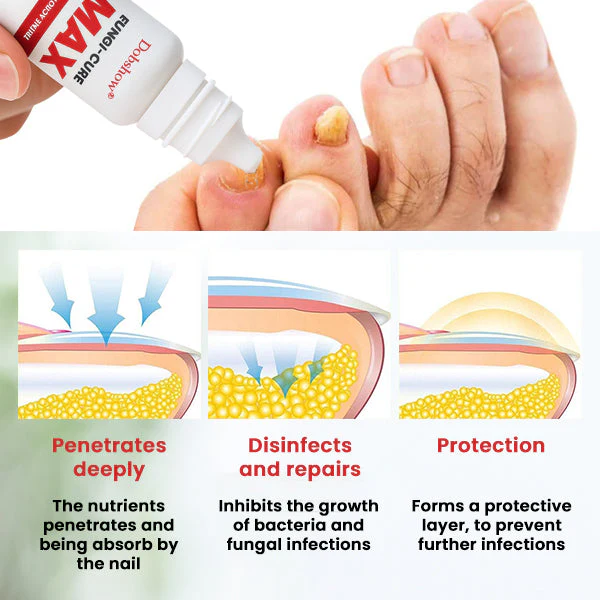 Dobshow® Fungi-Cure Max 5 Dobshow® Fungi-Cure Max