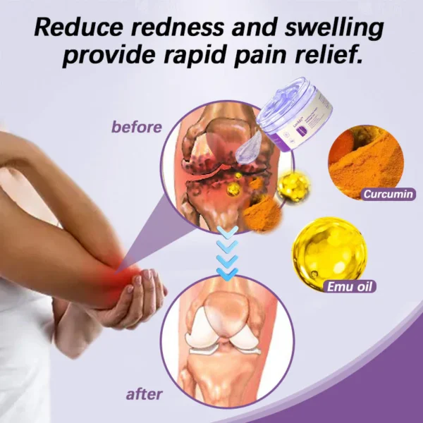 Lovilds™ Turmeric & Emu Oil Arthritis Soothing Pain Relief Massage Gel