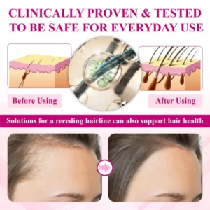 ATTDX® ThickHer Hair VitaGrowth Capsules image ATTDX® ThickHer Hair VitaGrowth Capsules