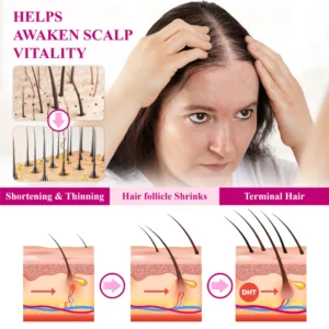 ATTDX® ThickHer Hair VitaGrowth Capsules image ATTDX® ThickHer Hair VitaGrowth Capsules