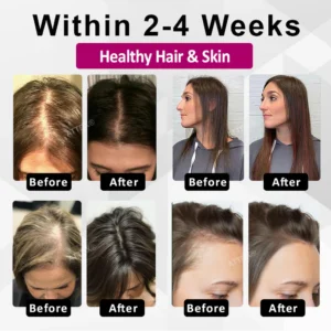 ATTDX® ThickHer Hair VitaGrowth Capsules image ATTDX® ThickHer Hair VitaGrowth Capsules