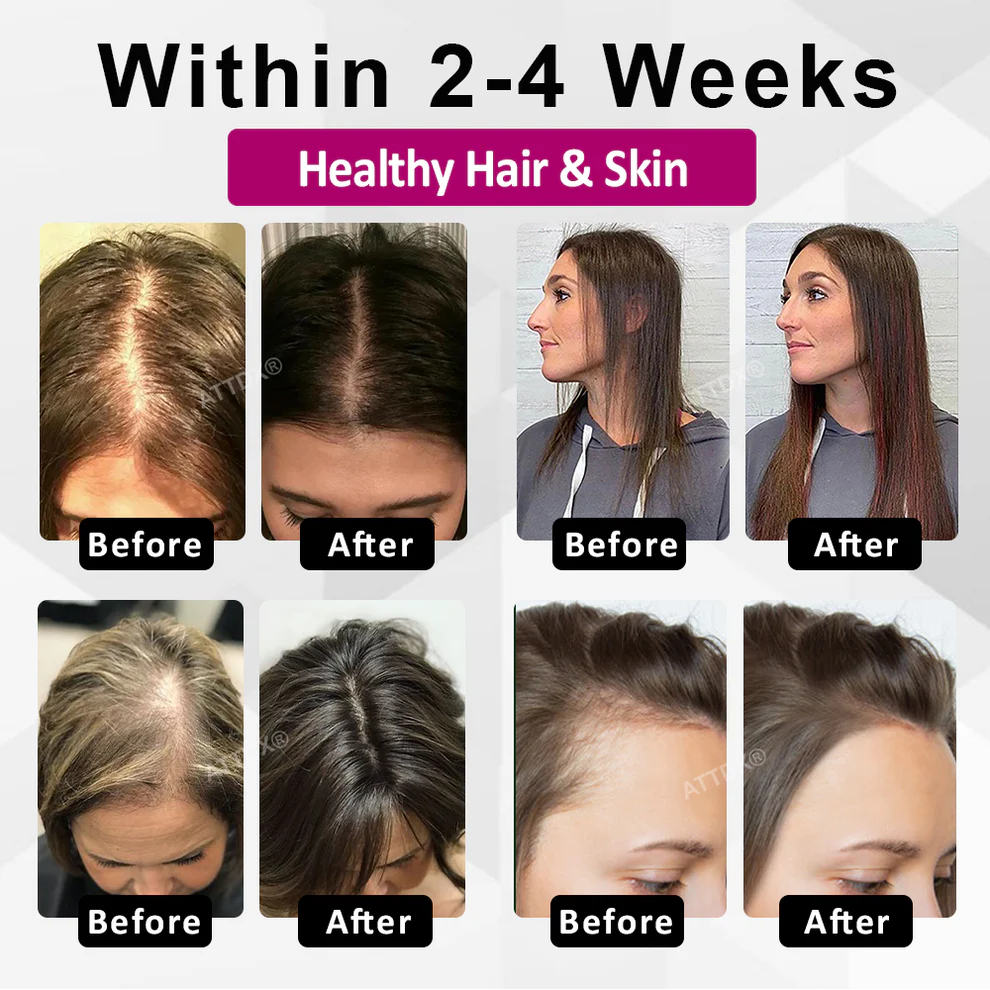 ATTDX® ThickHer Hair VitaGrowth Capsules image ATTDX® ThickHer Hair VitaGrowth Capsules