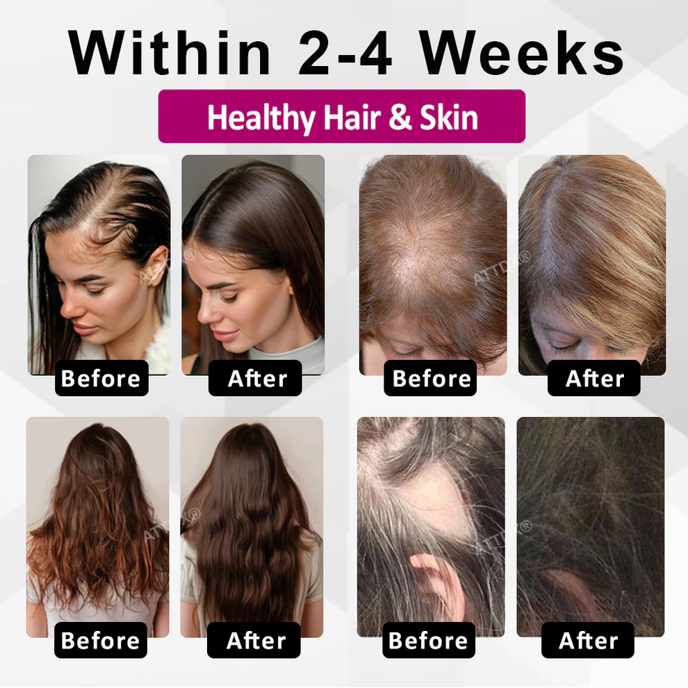 ATTDX® ThickHer Hair VitaGrowth Capsules image ATTDX® ThickHer Hair VitaGrowth Capsules