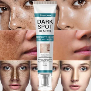 Bloobeac® Blemish Removing Beauty Cream