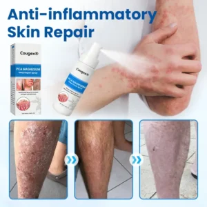 Cougex® PCA Magnesium Deep Repair Spray 16 Cougex® PCA Magnesium Deep Repair Spray