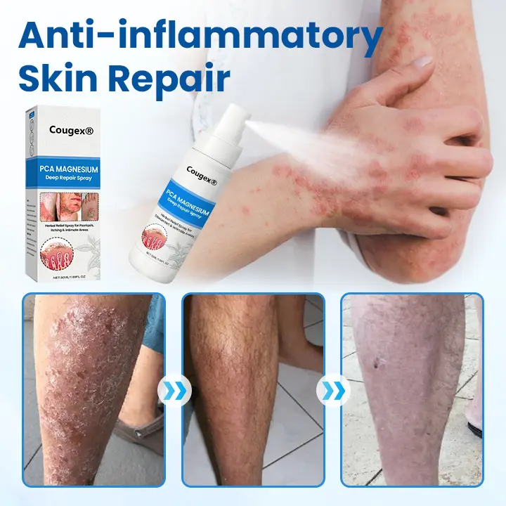 Cougex® PCA Magnesium Deep Repair Spray 6 Cougex® PCA Magnesium Deep Repair Spray