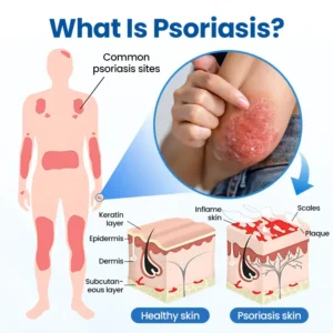 Cougex® PCA Magnesium Deep Repair Spray 18 Cougex® PCA Magnesium Deep Repair Spray