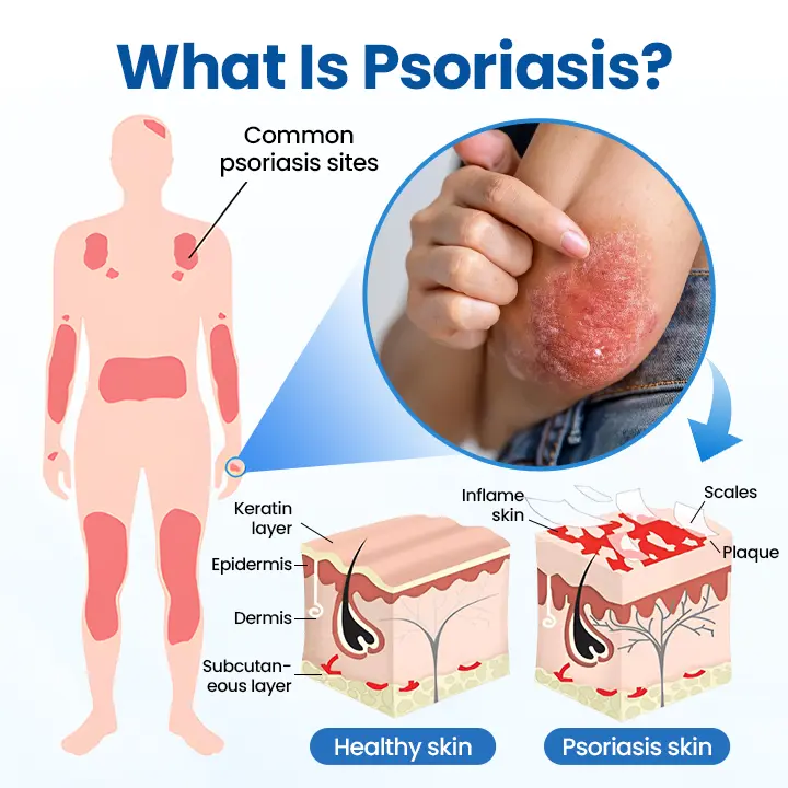 Cougex® PCA Magnesium Deep Repair Spray 8 Cougex® PCA Magnesium Deep Repair Spray