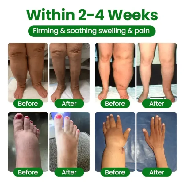 Cougex® VenoLift Leg Relief Spray