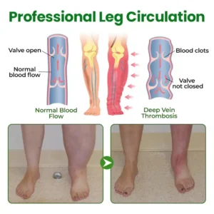 Cougex® VenoLift Leg Relief Spray 12 Cougex® VenoLift Leg Relief Spray