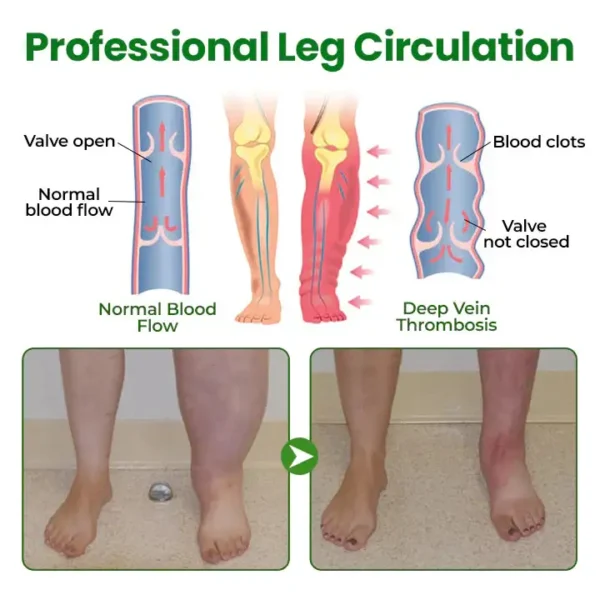 Cougex® VenoLift Leg Relief Spray