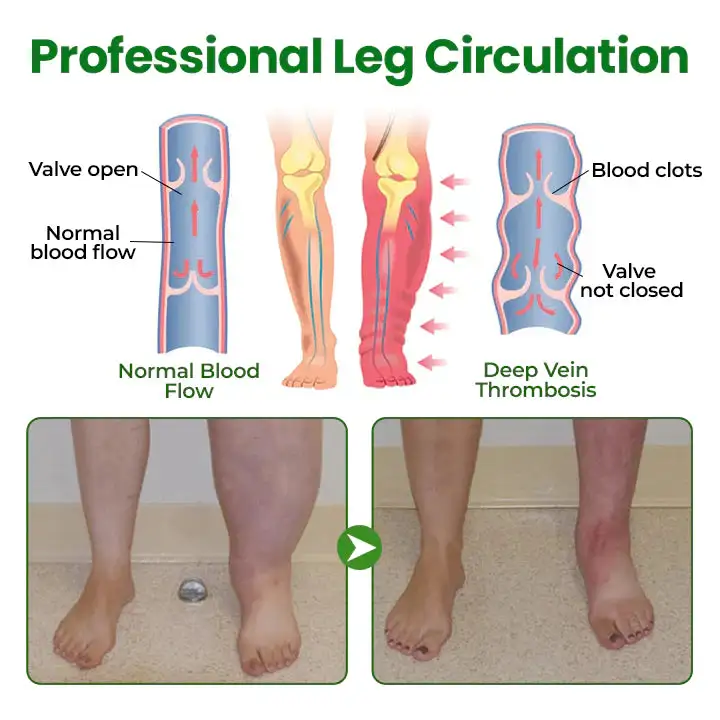 Cougex® VenoLift Leg Relief Spray 5 Cougex® VenoLift Leg Relief Spray