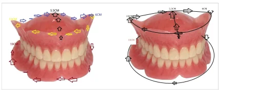 Yagoo™-Custom-Fit Full Functional Dentures image Yagoo™-Custom-Fit Full Functional Dentures