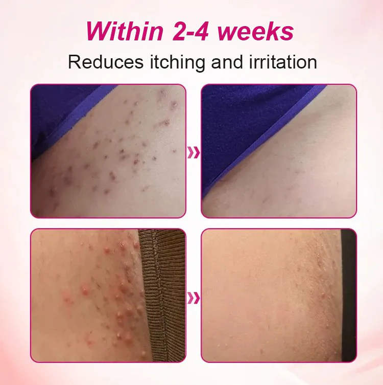 Alisanda Feminine Care Gel image Alisanda Feminine Care Gel