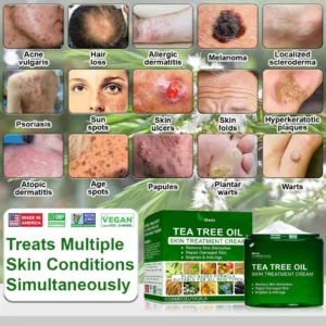 Skavix™ Tea Tree Oil Skin Treatment Cream 11 Skavix™ Tea Tree Oil Skin Treatment Cream