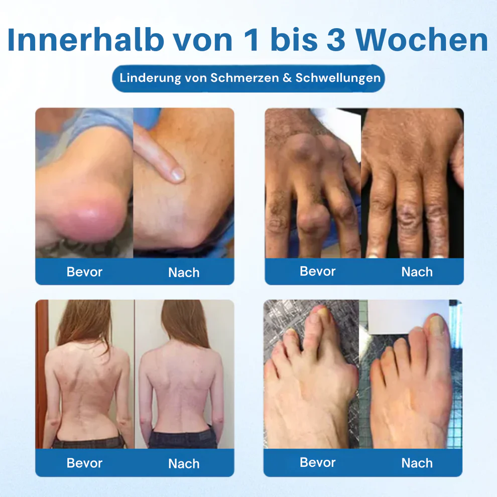 NovaRX® BPC-157 Joint Repair Cream image NovaRX® BPC-157 Joint Repair Cream