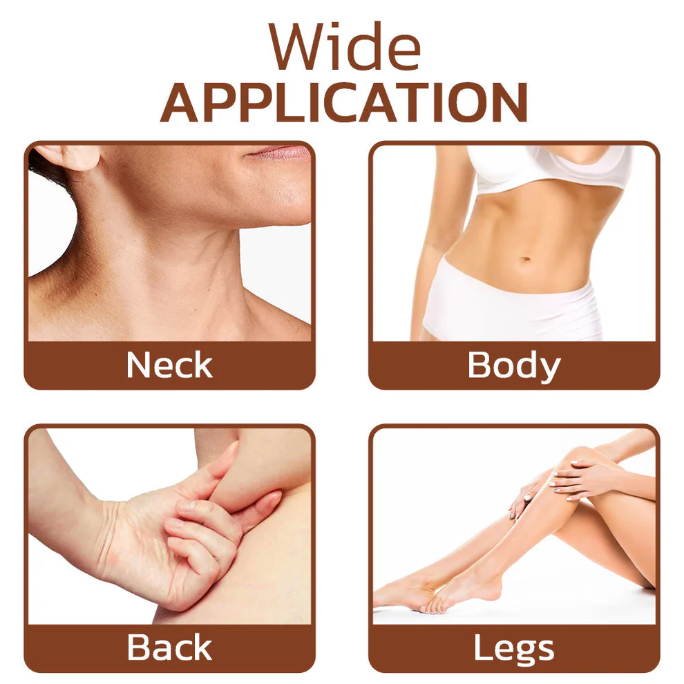 Cvreoz® Lumpless Lipoma Treatment Cream image Cvreoz® Lumpless Lipoma Treatment Cream