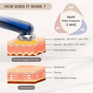Radiance One Handset (Official Retailer) 2025