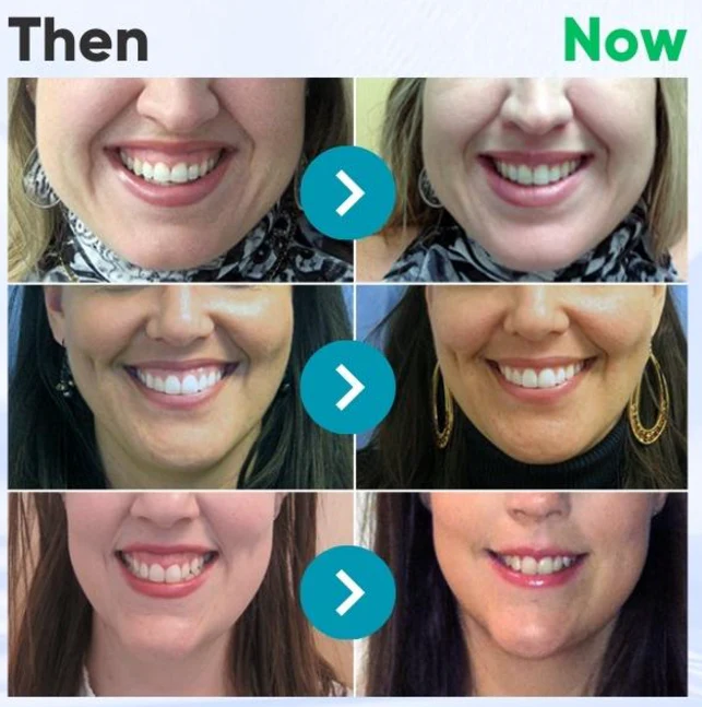 Furzero® Focussmile bee venom treatment powder image Furzero® Focussmile bee venom treatment powder