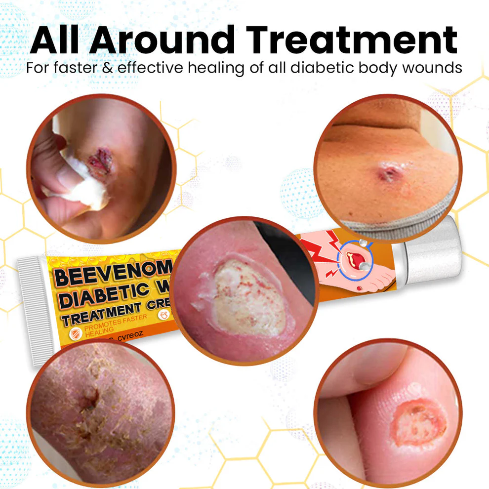 Cvreoz® Bee Venom Diabetic Wounds Treatment Cream 6 Cvreoz® Bee Venom Diabetic Wounds Treatment Cream