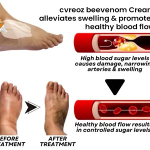 Cvreoz® Bee Venom Diabetic Wounds Treatment Cream 15 Cvreoz® Bee Venom Diabetic Wounds Treatment Cream